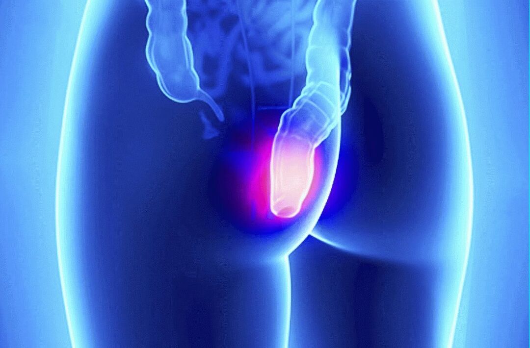 Gelarex se lahko uporablja tako zunanje kot rektalno